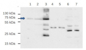 EDS1 | Enhanced disease susceptibility 1 in the group Antibodies Plant/Algal / Environmental Stress / Pathogen attack at Agrisera AB (Antibodies for research) (AS13 2751)